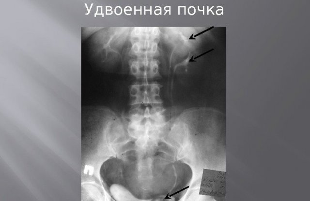 рентгеновский снимок